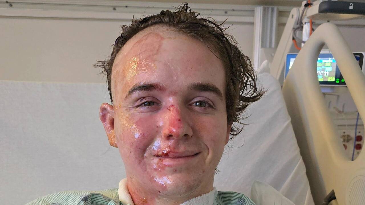 McDonald&rsquo;s employee, 20, rushed to hospital after co-worker &lsquo;threw hot oil over his face&rsquo; leaving him with serious burns