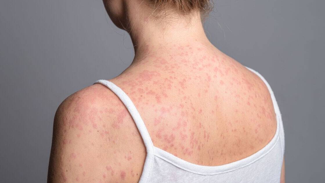 World Cup fans returning from US warned over carrying 'humankind's most contagious virus'