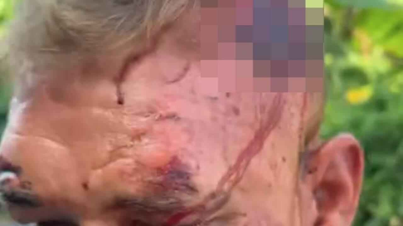 British tourist, 36, shows of bloody wounds after being &lsquo;spiked by local woman, beaten and robbed of &pound;1,800&rsquo;