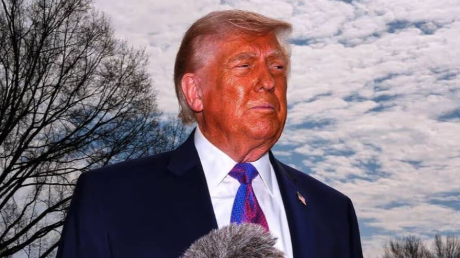 Makeup And Bruises: Donald Trump's Hand Injury Sparks Health Debate At White House